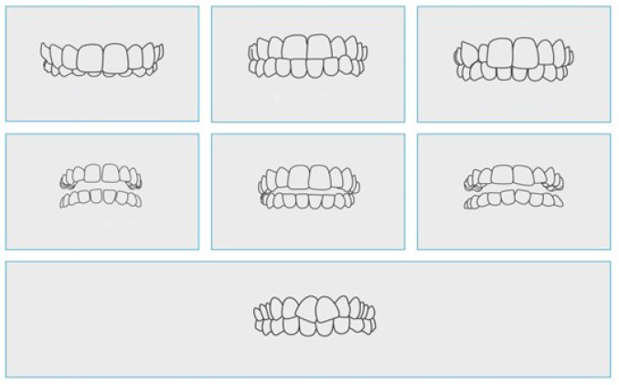 Line drawings of various dental occlusions arranged in a grid format, illustrating different bite alignments.