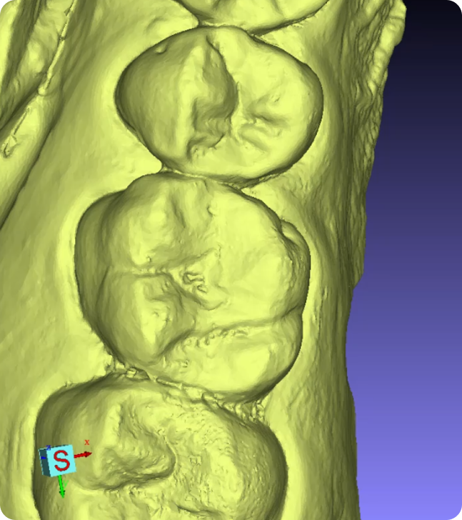 3D rendering of human knee joints showing detailed anatomy of femur, tibia, and patellar regions in yellow, with coordinate axes for orientation.