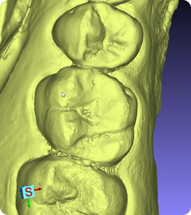 3D rendering of human knee joints in yellow tone, showcasing detailed bone structures and textures, with a Cartesian coordinate system illustrated in the lower left corner.