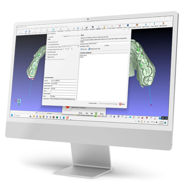 Computer screen displaying advanced dental software with 3D models of teeth, used for dental treatment planning and simulations.