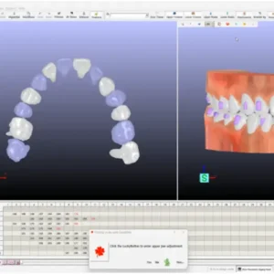 Dual-screen display of GuideMia dental software showing two different 3D models of teeth for comprehensive orthodontic planning.