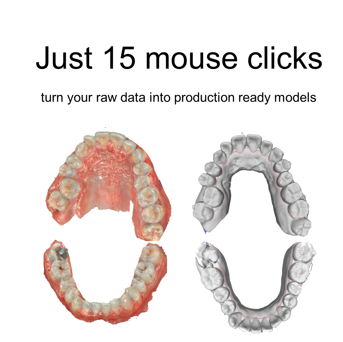 Promotional graphic displaying three stages of dental scans, showing the transformation from raw data to production-ready models with the caption 'Just 15 mouse clicks