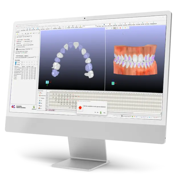 Computer monitor showing GuideMia dental software interface with dual 3D models of teeth for treatment planning.